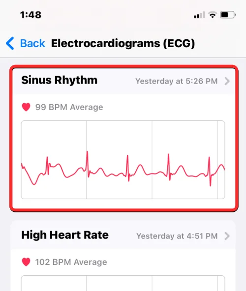 Apple Watch에 ECG 기록: 단계별 가이드
