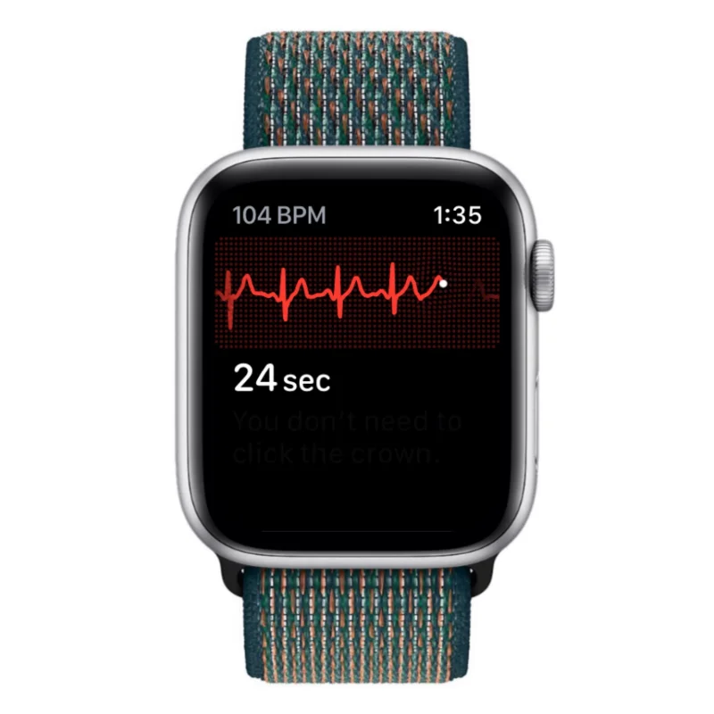 Apple Watch에 ECG 기록: 단계별 가이드