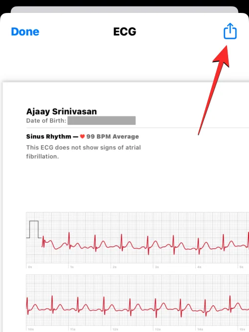 Apple Watch에 ECG 기록: 단계별 가이드