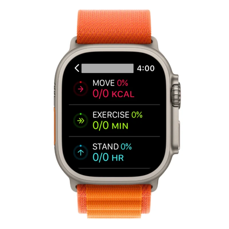 Apple Watch에서 피트니스 공유: 단계별 가이드
